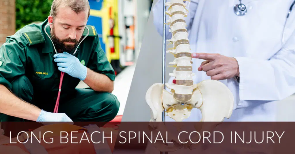 médico señalando la columna vertebral en el esqueleto