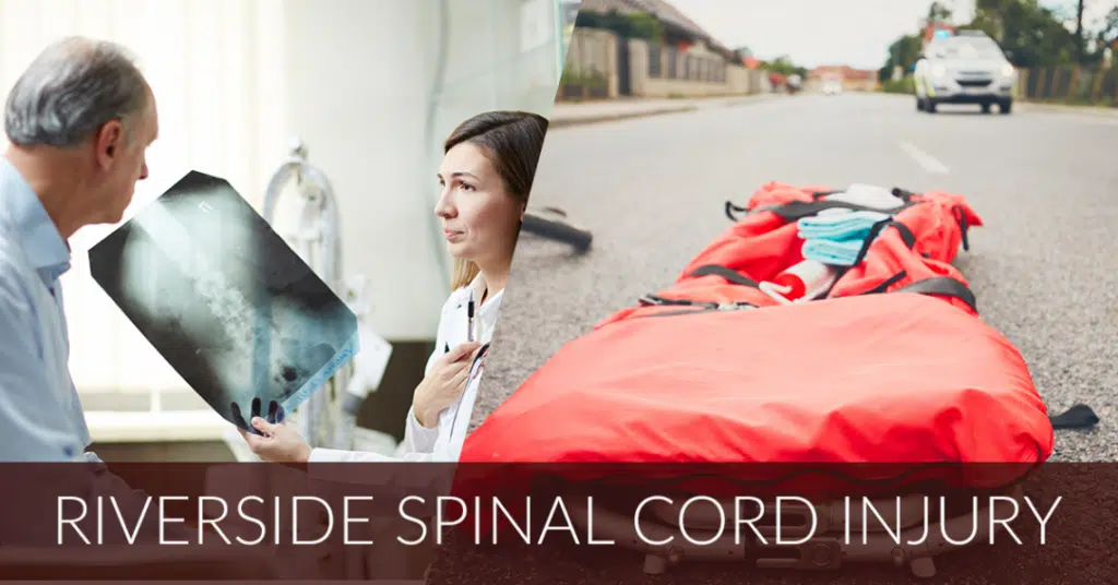 doctor reviewing x-ray of spine